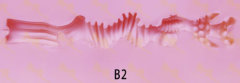 B2