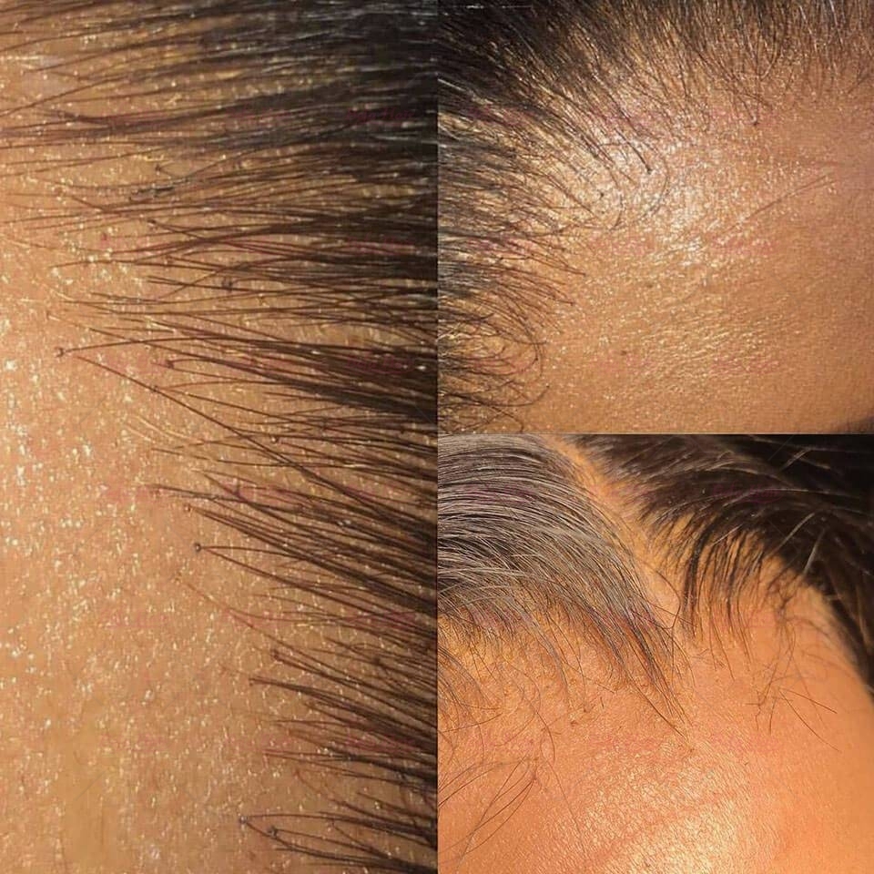 Wholesale 5x5 Free Part HD Lace Body Wave Unprocessed Human Hair Closure 12-20 Inch,can do dropshipping