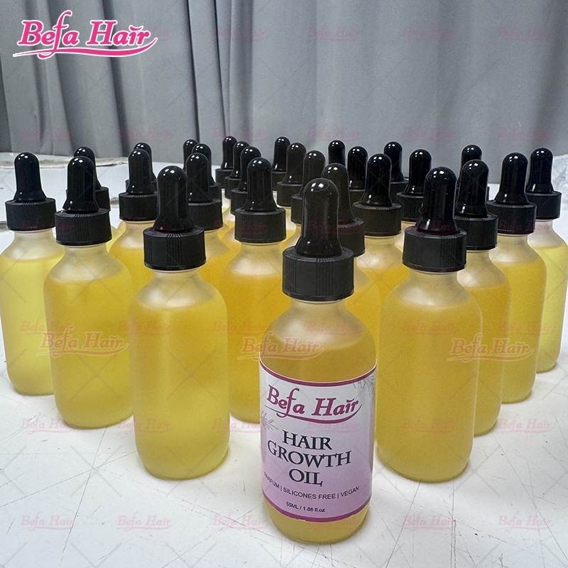 Private Label Hair Growth Oil Natural Organic Hair Treatment Rosemary Oil For Hair Growth