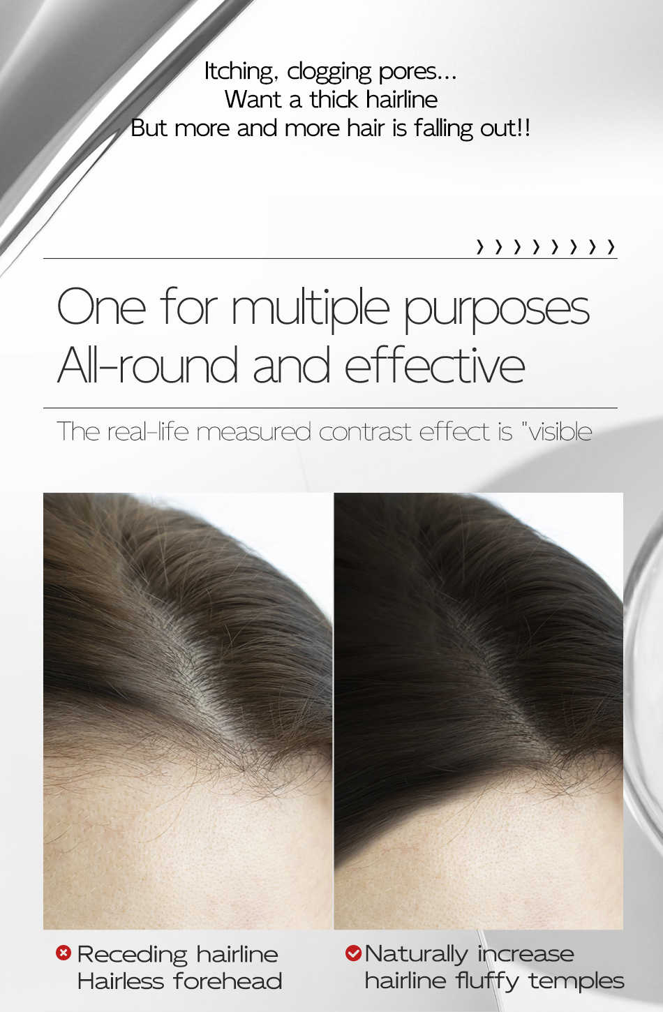 Before and after receding hairline versus fuller temples