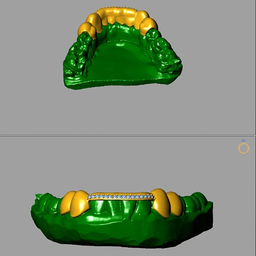 Custom Sterling Silver Grillz With VVS Center 1Row Diamond Tooth Grillz High Quality for Your Teeth Hip Hop Christmas Accessory