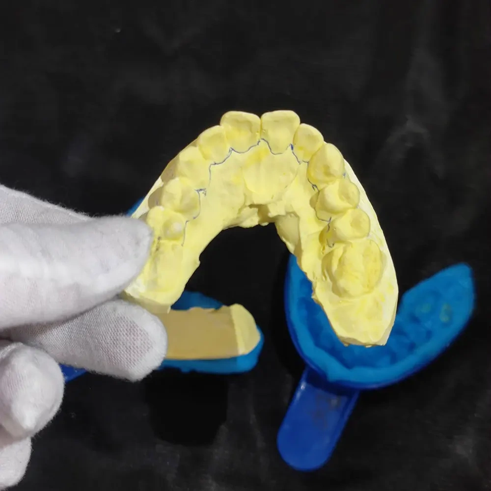 Custom Personalized VVS Moissanite Up8 Dental Braces Mens Hip Hop Bling lced Out 925 Silver Sterling Grillz Teeth Decoration