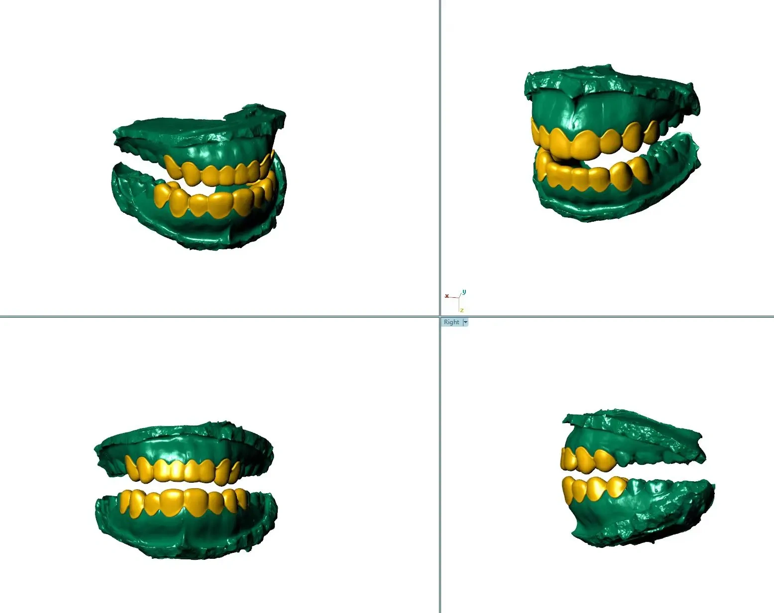 Custom Jewelry Hip Hop Flawless VVS Moissanite Grillz 8/10 Top & 8/10 Bottom 925 Sterling Silver Iced Out Teeth Grillz