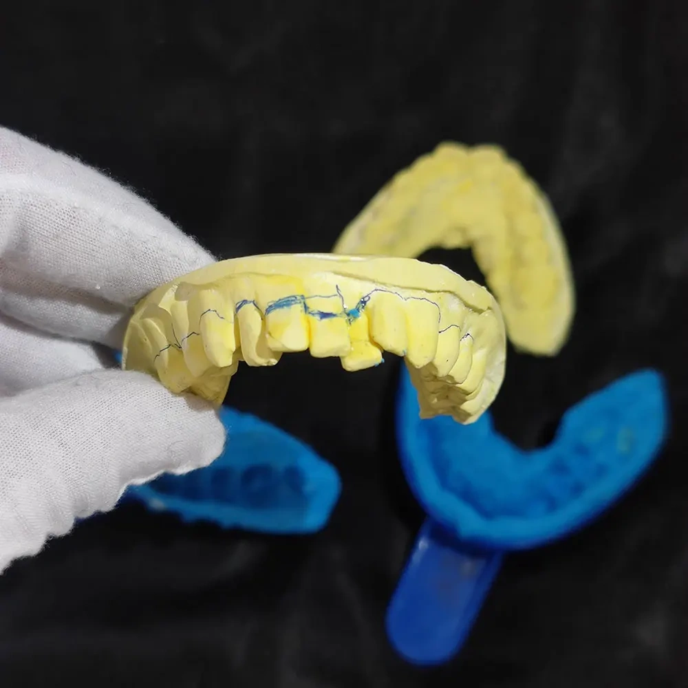 Custom Personalized VVS Moissanite Up8 Dental Braces Mens Hip Hop Bling lced Out 925 Silver Sterling Grillz Teeth Decoration