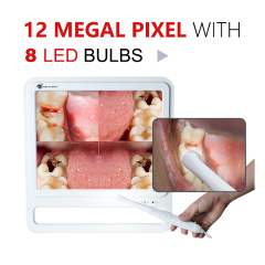 Cost-effective endoscope,Cost-effective endoscope