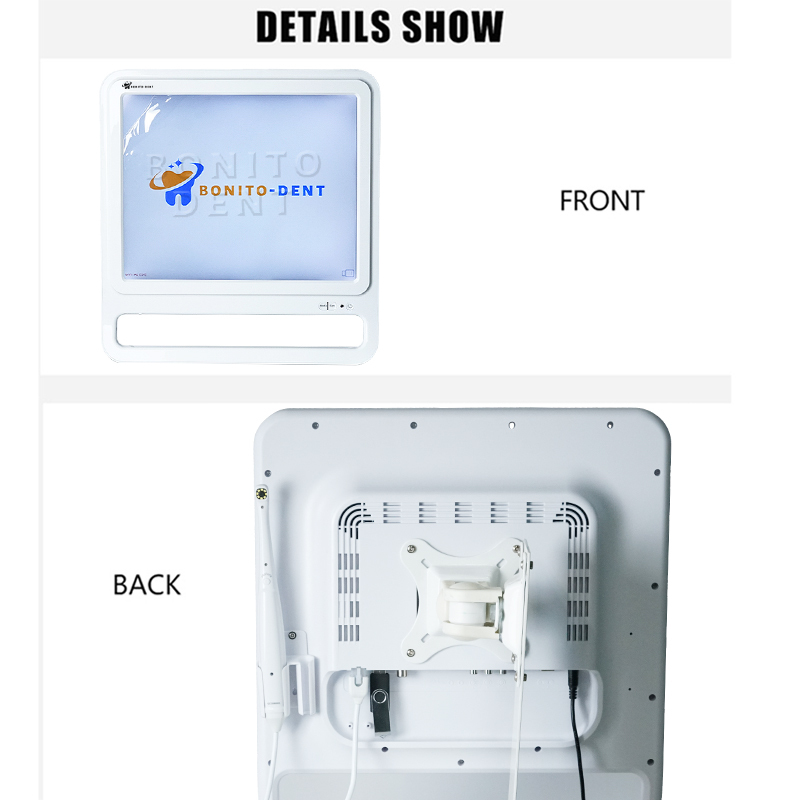 Cost-effective endoscope,Cost-effective endoscope