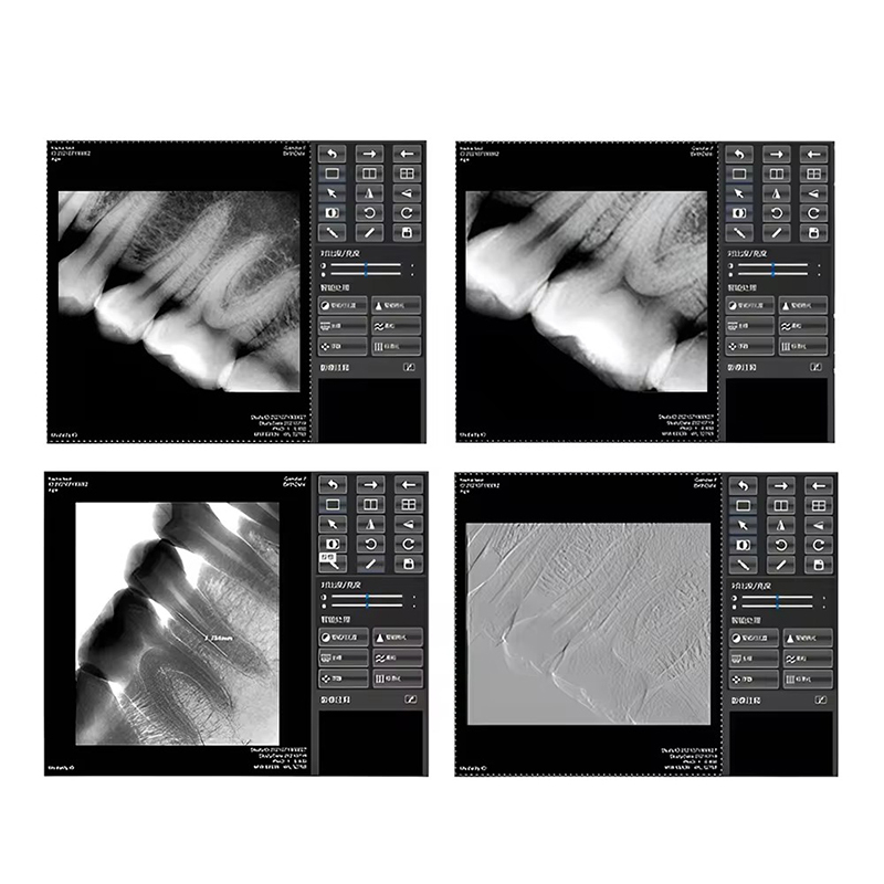 Medical Equipment Portable Digital Dental X-ray Machine With  RVG Sensor Handheld X Ray Unit Intraoral Imaging Sensor,Medical Equipment Portable Digital Dental X-ray Machine With  RVG Sensor Handheld X Ray Unit Intraoral Imaging Sensor
