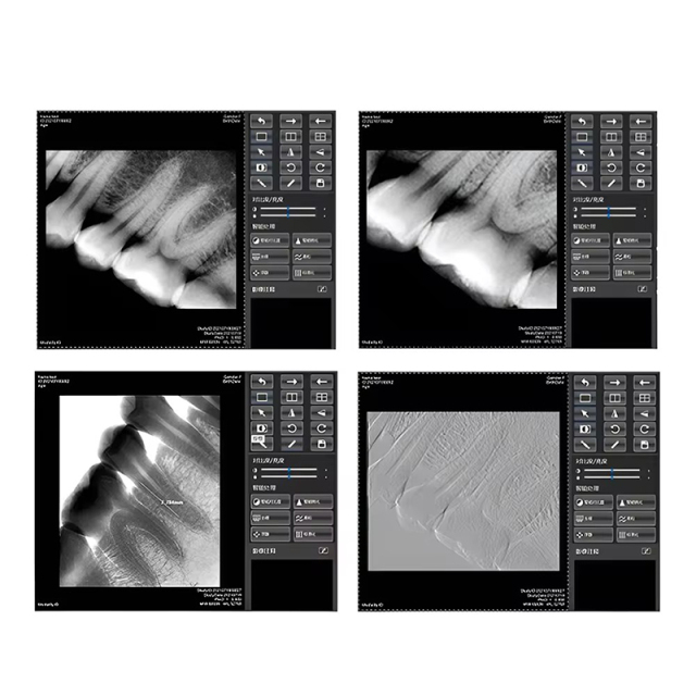Medical Equipment Portable Digital Dental X-ray Machine With  RVG Sensor Handheld X Ray Unit Intraoral Imaging Sensor,Medical Equipment Portable Digital Dental X-ray Machine With  RVG Sensor Handheld X Ray Unit Intraoral Imaging Sensor