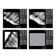 Medical Equipment Portable Digital Dental X-ray Machine With  RVG Sensor Handheld X Ray Unit Intraoral Imaging Sensor,Medical Equipment Portable Digital Dental X-ray Machine With  RVG Sensor Handheld X Ray Unit Intraoral Imaging Sensor