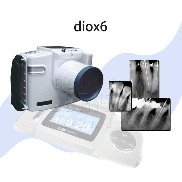 Dental Portable X-Ray Machine Digital Mobile Dental X-Ray Unit System DIO-X6,Dental Portable X-Ray Machine Digital Mobile Dental X-Ray Unit System DIO-X6