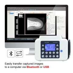 Portable High Frequency 2 in 1  X-ray Instant Camera Handheld Dental Xray Machine Digital Sensor Radiography Machine,Portable High Frequency Dental X-Ray Machine with Built-in Screen & Digital Sensor | Cordless Handheld Dental Radiography System for Clinic & Mobile Use