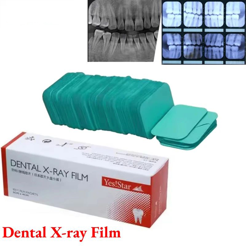 100 Pieces Per Box Dental X-Ray D Speed Turbine Film for Dental Image Diagnosis,100 Pieces Per Box Dental X-Ray D Speed Turbine Film for Dental Image Diagnosis