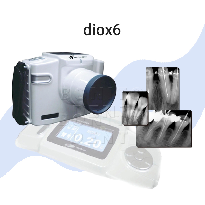 Dental Portable X-Ray Machine Digital Mobile Dental X-Ray Unit System DIO-X6,Dental Portable X-Ray Machine Digital Mobile Dental X-Ray Unit System DIO-X6