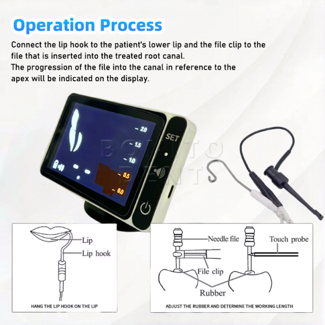Dental Endo Apex Locator Root Canal Apex Location Periodontics Measurement Measuring Equipment  CE Certified Class Il Instrument,Dental Endo Apex Locator Root Canal Apex Location Periodontics Measurement Measuring Equipment  CE Certified Class Il Instrument