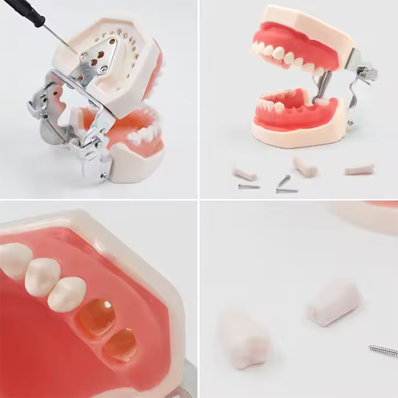 Hot Sale M8012 Standard Dental Tooth Model with 32 Screw-in Teeth Factory Price High Quality Dental Equipment,Hot Sale M8012 Standard Dental Tooth Model with 32 Screw-in Teeth Factory Price High Quality Dental Equipment