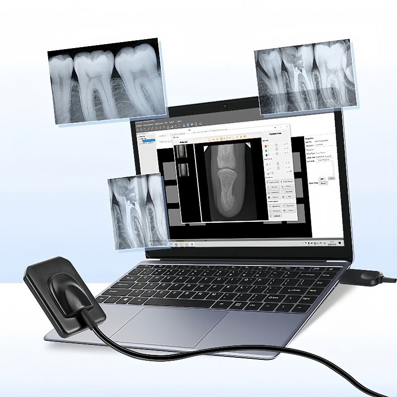Portable Rayos X Digital RVG Intraoral Sensor Radiovisografo HD Image Dental Sensor for Clinic,Portable Rayos X Digital RVG Intraoral Sensor Radiovisografo HD Image Dental Sensor for Clinic