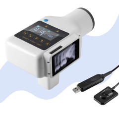 Dental Portable X-ray Machine Instant Camera with Instant LCD Image Display and Built-in Sensor With CE Certified,Dental Portable X-ray Machine Instant Camera with Instant LCD Image Display and Built-in Sensor With CE Certified