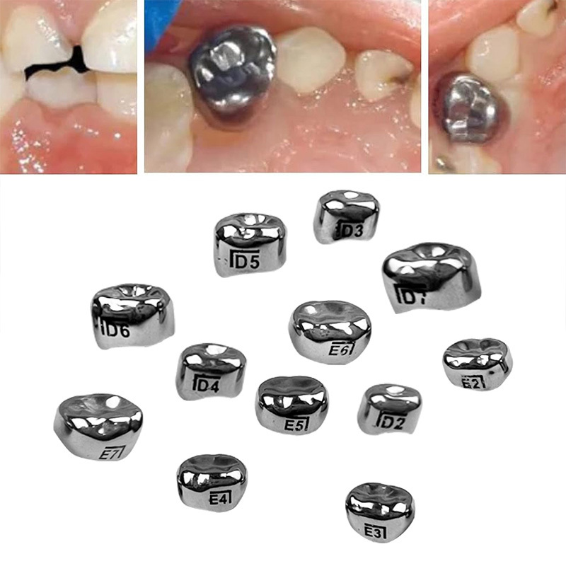 48pcs/box Dental Kids Adult Stainless Steel Orthodontic Pediatric Crowns Braces Primary Molar Crown Dentistry Tool CE Certified,48pcs/box Dental Kids Adult Stainless Steel Orthodontic Pediatric Crowns Braces Primary Molar Crown Dentistry Tool CE Certified