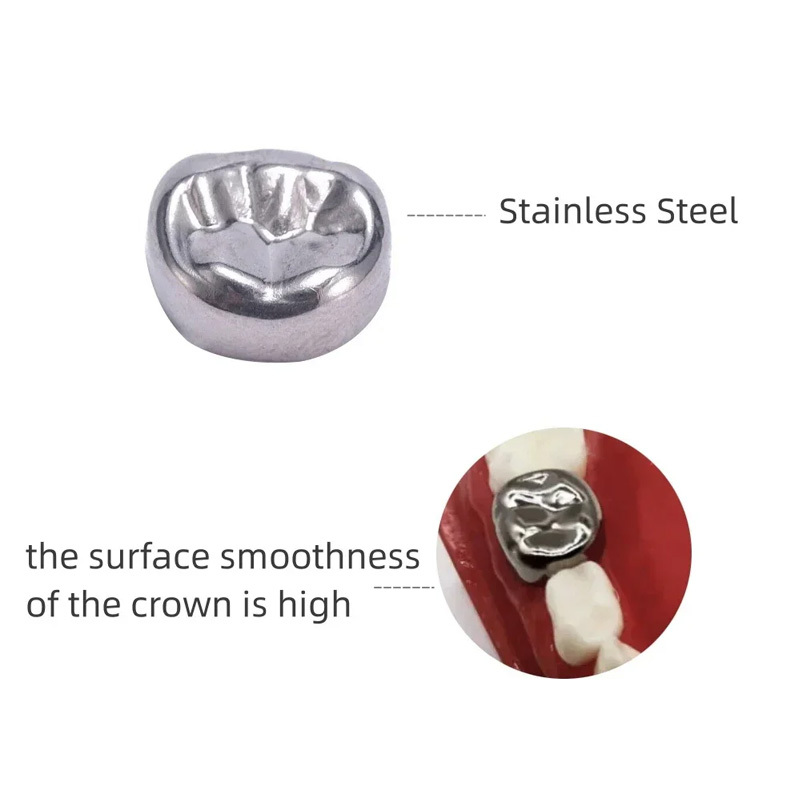 48pcs/box Dental Kids Adult Stainless Steel Orthodontic Pediatric Crowns Braces Primary Molar Crown Dentistry Tool CE Certified,48pcs/box Dental Kids Adult Stainless Steel Orthodontic Pediatric Crowns Braces Primary Molar Crown Dentistry Tool CE Certified