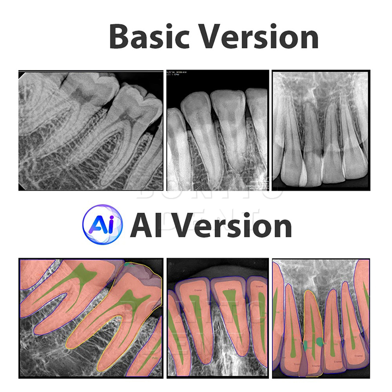 Dental RVG Sensor Portable Dentist Intraoral System Image HDR Sensor Dental Radiographic Digital Sensor Free Driver AI Software,Dental RVG Sensor Portable Dentist Intraoral System Image HDR Sensor Dental Radiographic Digital Sensor Free Driver AI Software