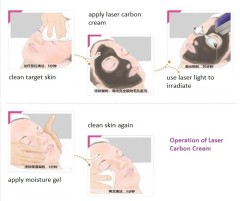 Skin Rejuvenation Carbon Cream