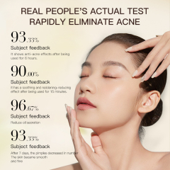Niacinamide Salicylic Acid Soothing Skin Controlling Oil Removing Acne Moisturizing and Moisturizing Skin 10ml Powder Essence