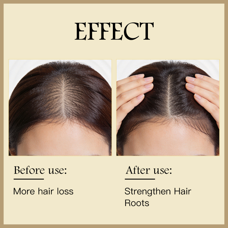 Custom Private Label Anti Hair Loss Shampoo Natural Herbal Nourishing Scalp Care Prevent Thinning Hair Shampoo