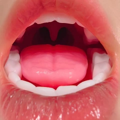 ROS Mouth (Standard configuration)