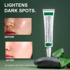 OEM Vegan Korean Skin Care Dark Spot Correcting Glow Serum 5% Niacinamide Dark Spot Remover Face Serum for Face