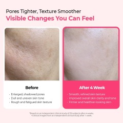 Private Label Collagen Niaciamide Pink Spicule Vitamin B12 Boosting Liquid Mircroneedling Eye Face Serum for Dark Circles