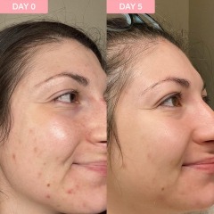 Private Label Anti Wrinkle Pink Face Serum Hyaluronic Acid Vitamin C Dark Sport Serum Retinol Bakuchiol Peptide Serum