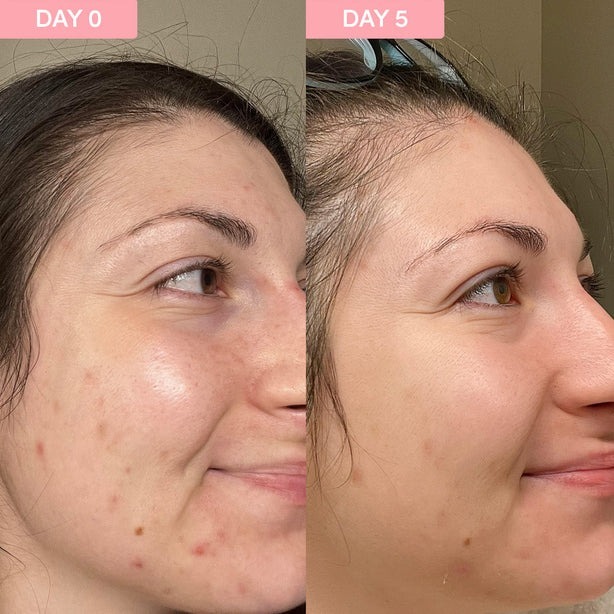 Private Label Anti Wrinkle Pink Face Serum Hyaluronic Acid Vitamin C Dark Sport Serum Retinol Bakuchiol Peptide Serum