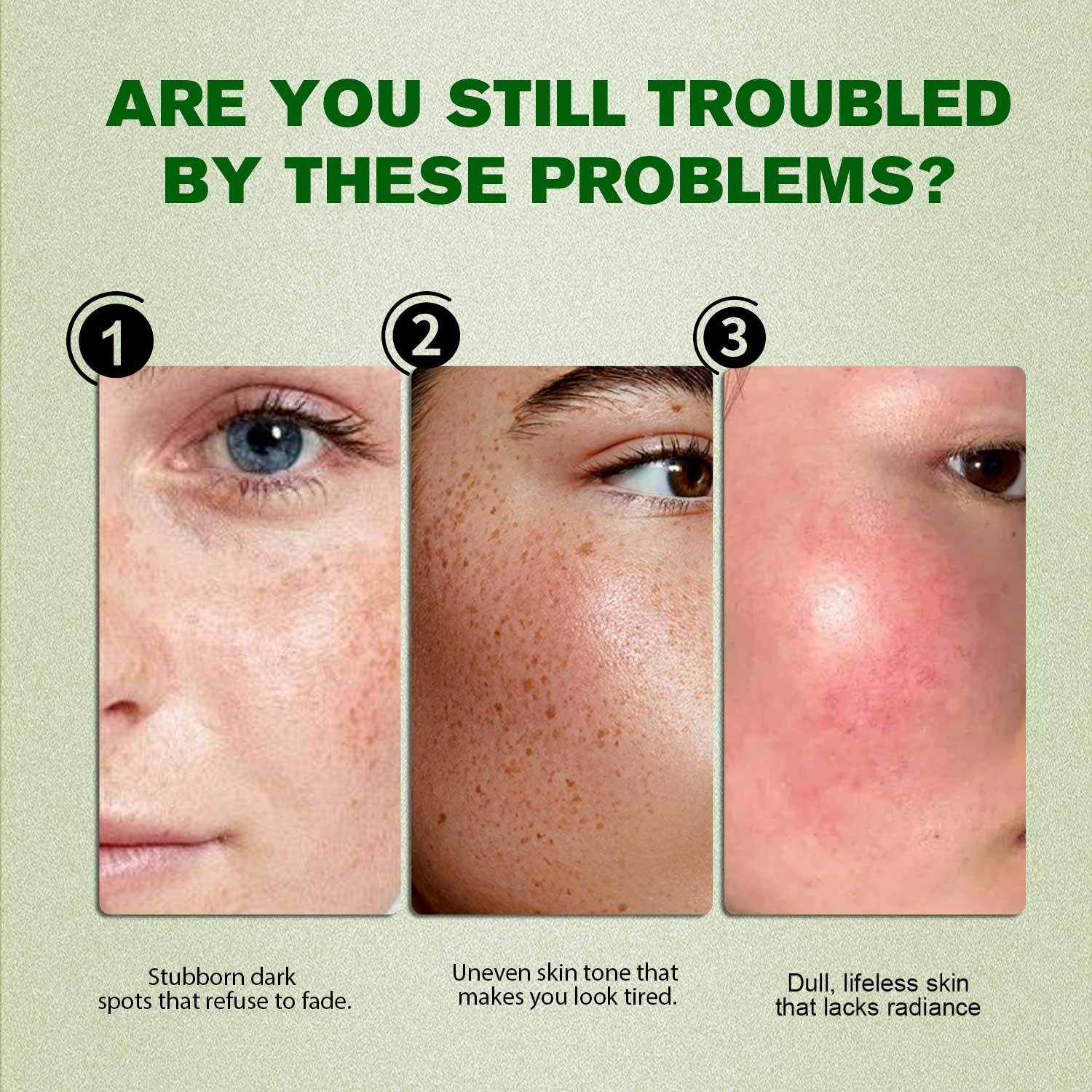 OEM Vegan Korean Skin Care Dark Spot Correcting Glow Serum 5% Niacinamide Dark Spot Remover Face Serum for Face