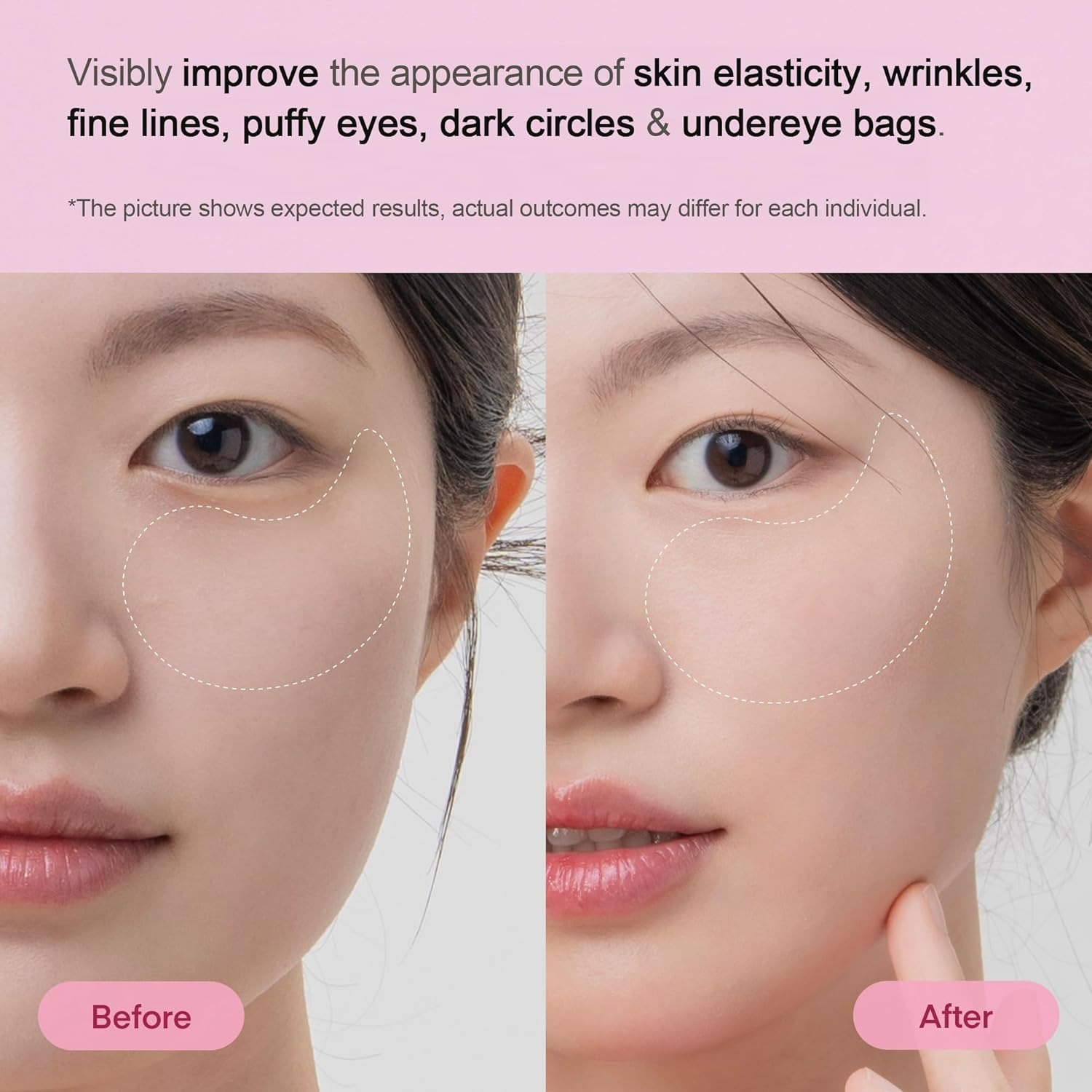 OEM Peptide Collagen Under Eye Patches Korean Firming Glowing Hydrating Hydrogel Mask for Puffy Eyes Dark Circles