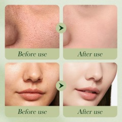 Private Label Savings Green Avocado Skin Care  Kojic Acid and Glutathione Face Care Kit