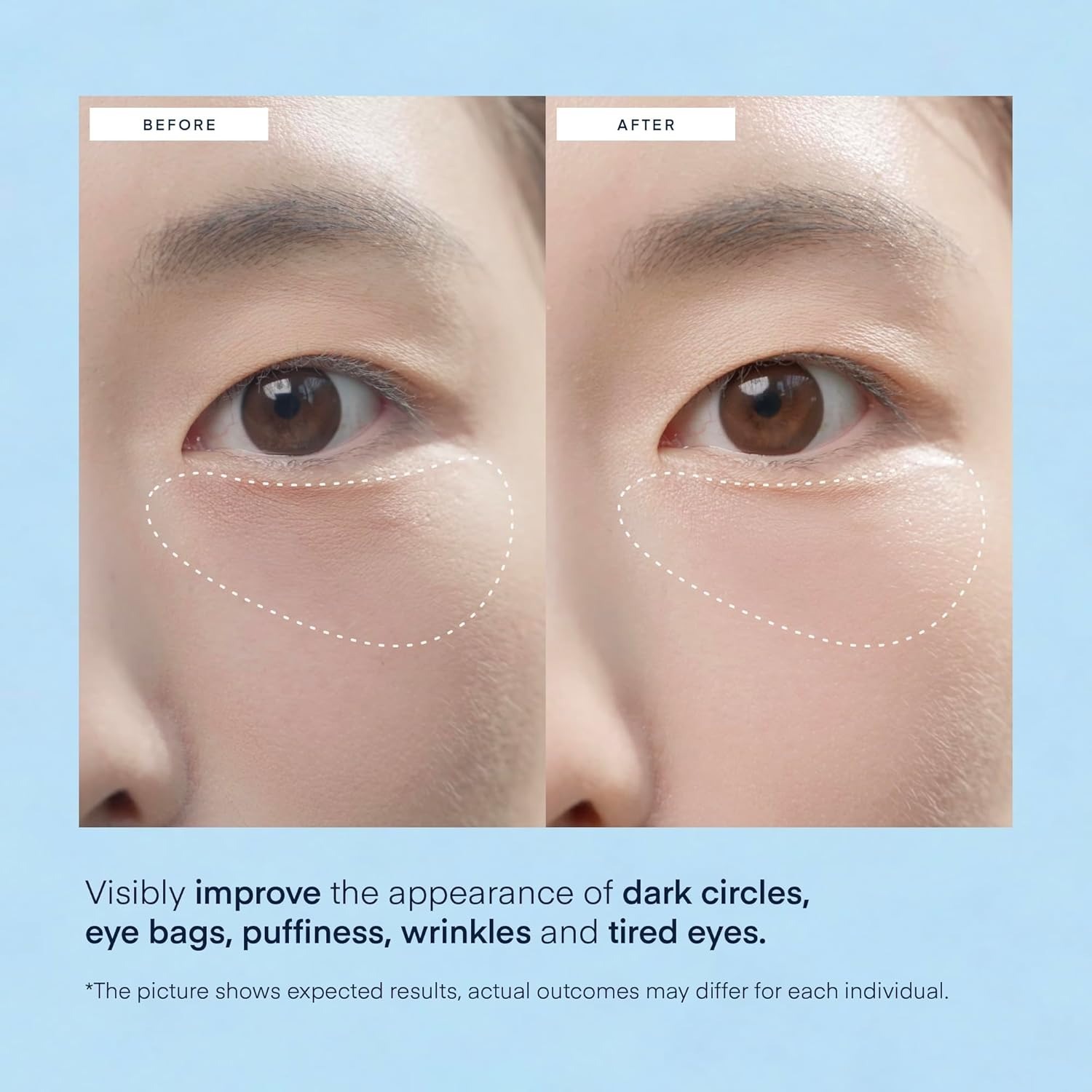 Private Label Vegan Retinol Collagen Eye Gels Mask Reduce Wrinkles Puffy & Bags Skin Treatment Under Eye Pads