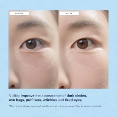 Private Label Vegan Retinol Collagen Eye Gels Mask Reduce Wrinkles Puffy & Bags Skin Treatment Under Eye Pads