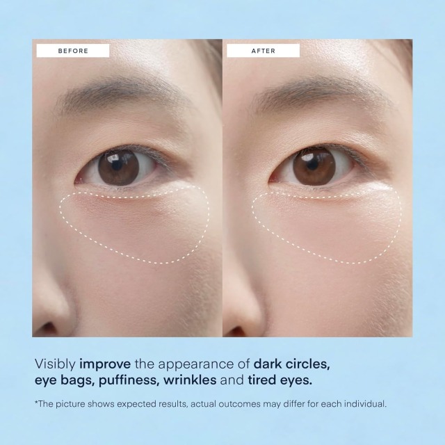 Private Label Vegan Retinol Collagen Eye Gels Mask Reduce Wrinkles Puffy & Bags Skin Treatment Under Eye Pads