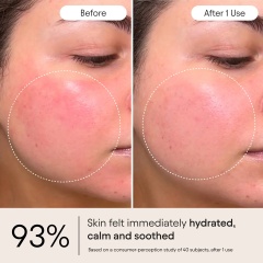 Custom Barrier Repair Cream 5 Ceramide Complex Super Peptides Ghost Berry Barrier Repair Hydrating OEM Eczema Face Mositurizer