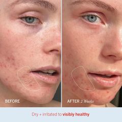 Customizable Intense Hydration Intense Repair Cream Ceramide Hyaluronic Acid Deep Moisturizing Repair Skin Barrier for Dry Skin