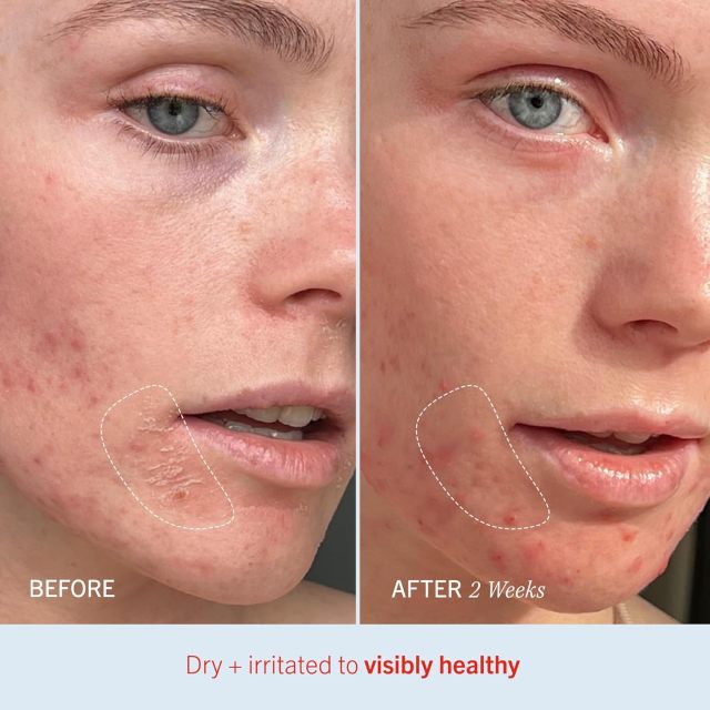 Customizable Intense Hydration Intense Repair Cream Ceramide Hyaluronic Acid Deep Moisturizing Repair Skin Barrier for Dry Skin
