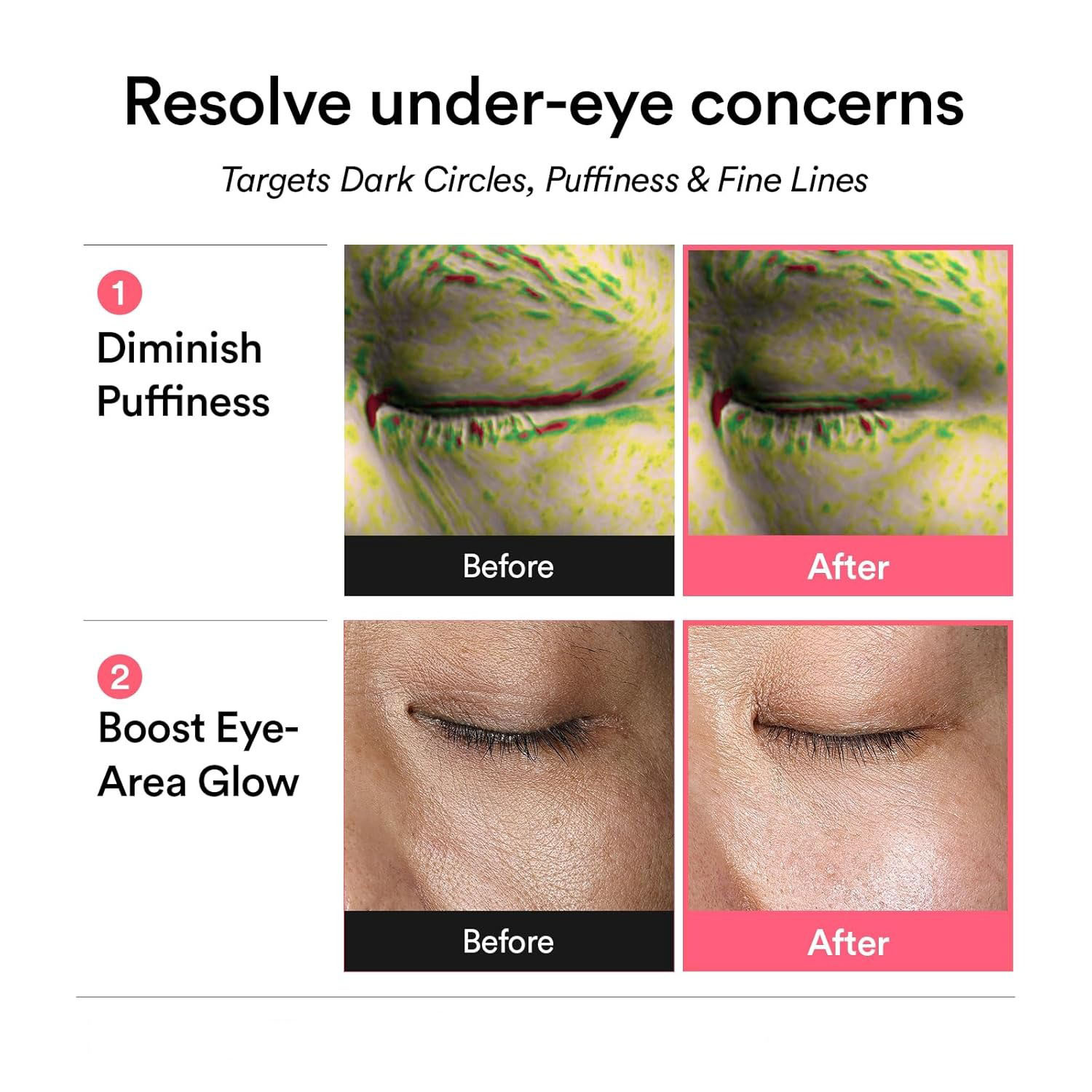 OEM Vegan PDRN Salmon Hyaluronic Acid Collagen Hydrogel Eye Mask Reduce Eye Bags & Dark Circles Under Pink Gel Gold Patches