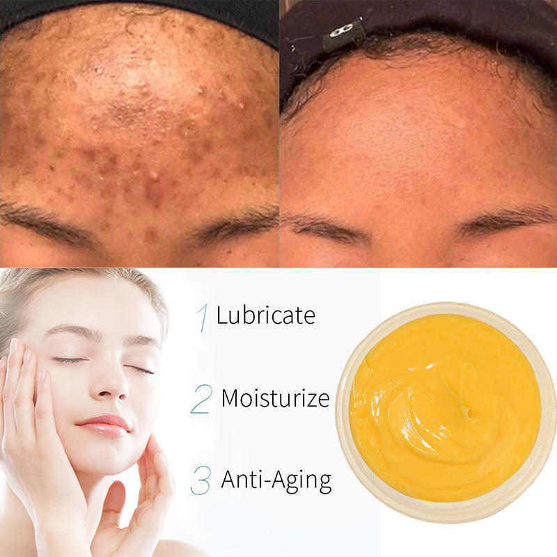 Wholesale OEM Organic Vegan Turmeric Face Cream Skin Lightening Whitening Acne Relief Anti-Aging Lightening Dark Spots for Women