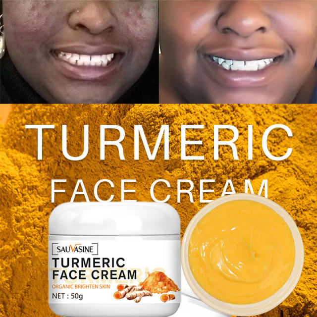 Wholesale OEM Organic Vegan Turmeric Face Cream Skin Lightening Whitening Acne Relief Anti-Aging Lightening Dark Spots for Women