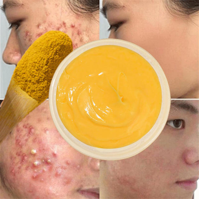 Wholesale OEM Organic Vegan Turmeric Face Cream Skin Lightening Whitening Acne Relief Anti-Aging Lightening Dark Spots for Women