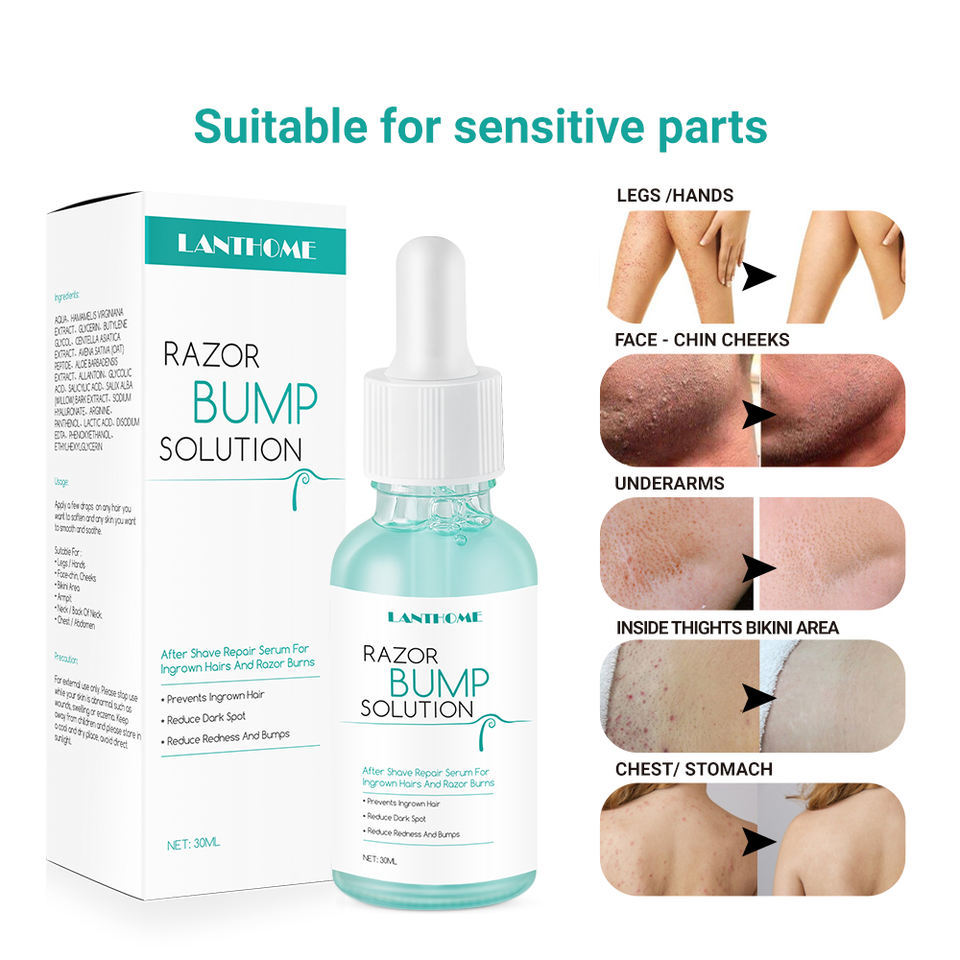 High Quality Ingrown Hair Serum Men Liquid OEM Men and Women Toner Razor Bump Oil After Shave Lotion