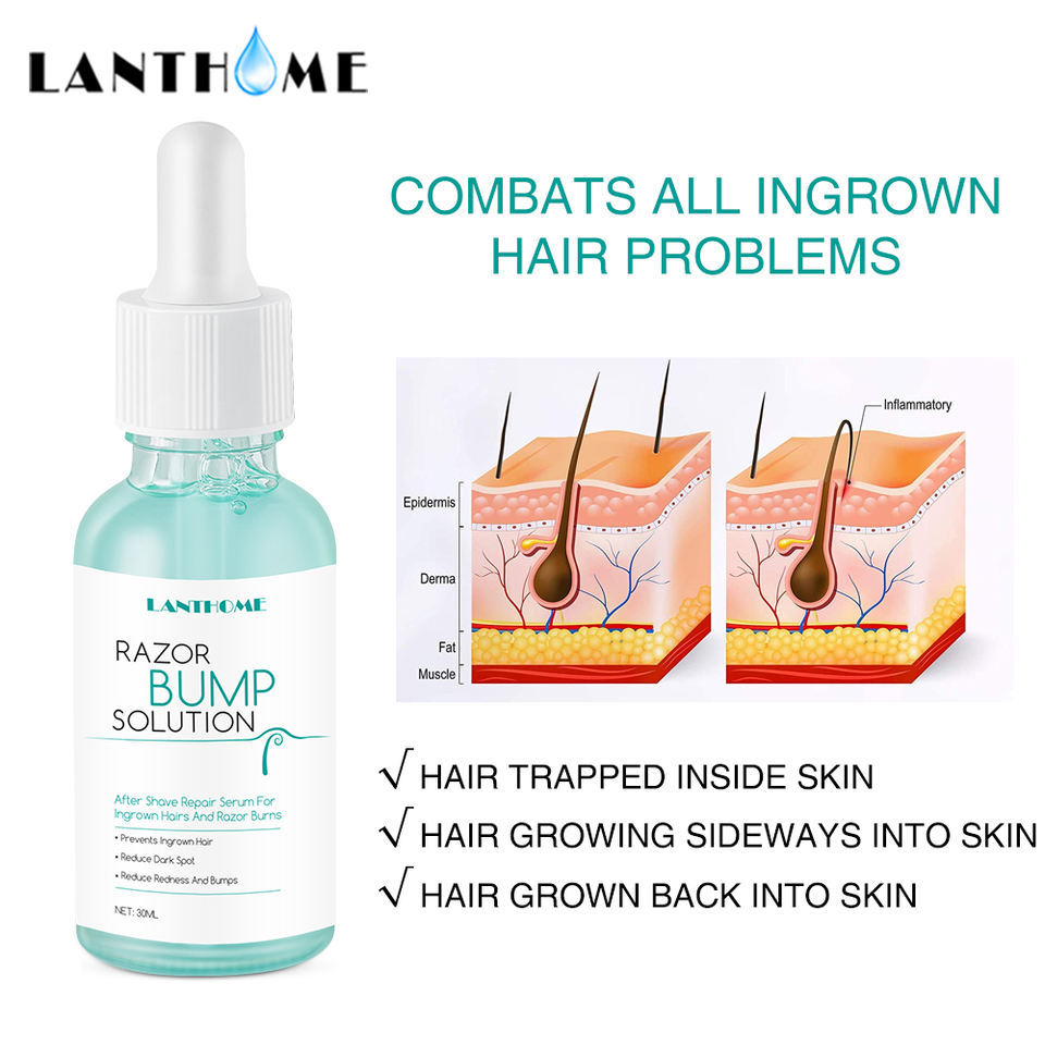 High Quality Ingrown Hair Serum Men Liquid OEM Men and Women Toner Razor Bump Oil After Shave Lotion