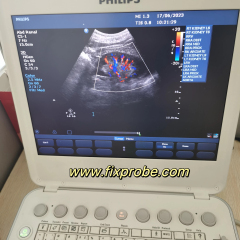 Philips CX-50 Ultrasound System Repair and sale
