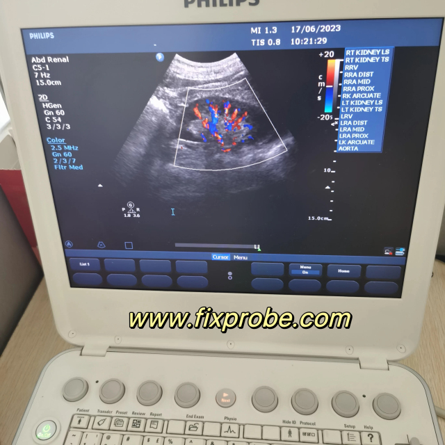 Philips CX-50 Ultrasound System Repair and sale
