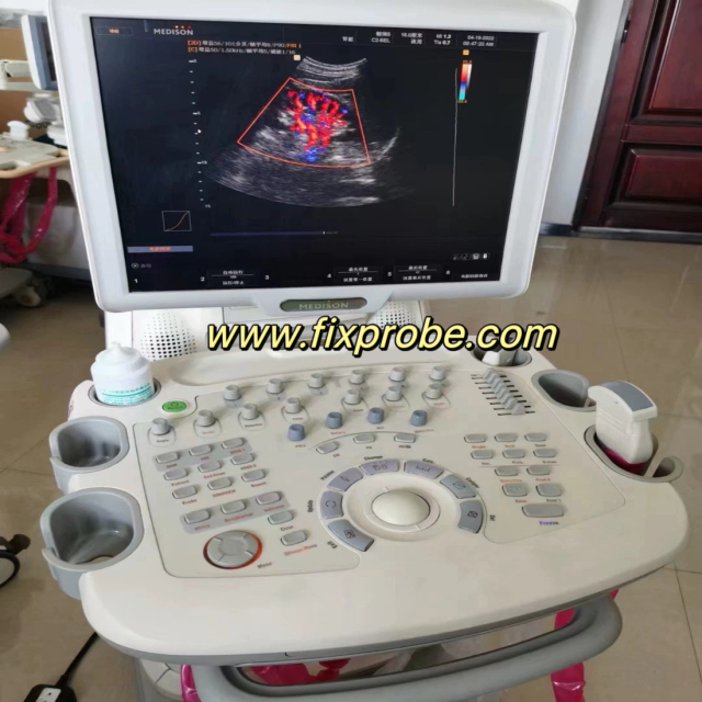 SONOACE X8 Ultrasound System Repair and sale